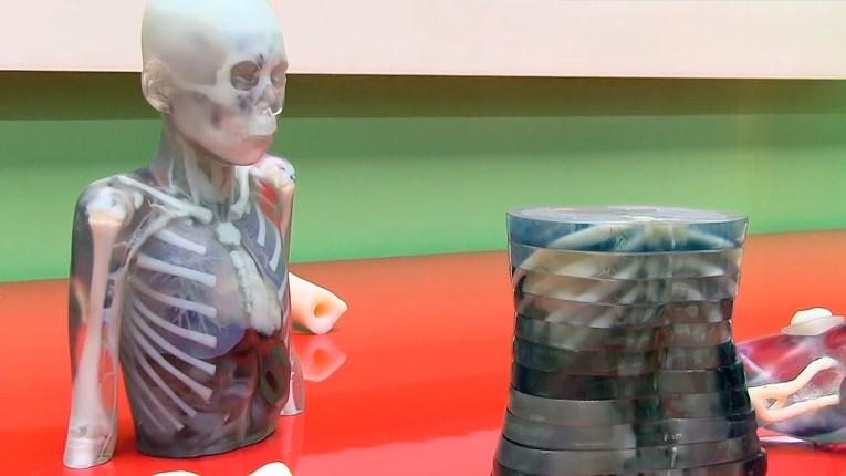 Medical 3D Printing: Uses, Benefits, and Limits - Cover Image