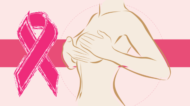 Breast Cancer Prevention: Practical Steps That May Lower Risk - Cover Image