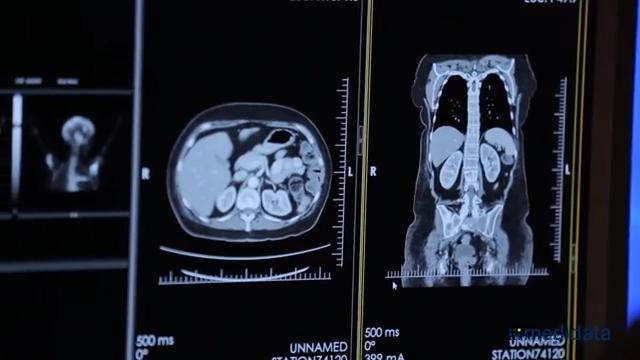 CT Scan