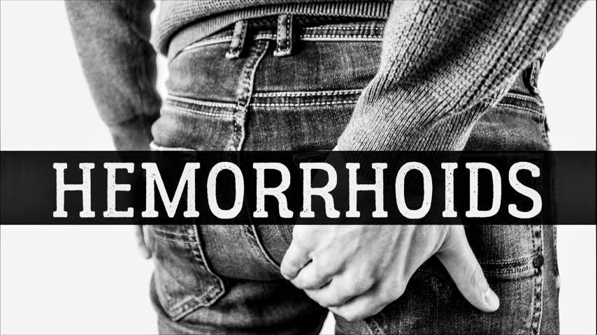 Hemorrhoids (Piles): Symptoms, Treatment Options, and Prevention - Cover Image