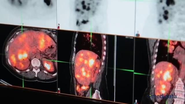 CT Scan