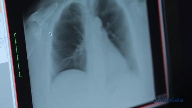 X-ray